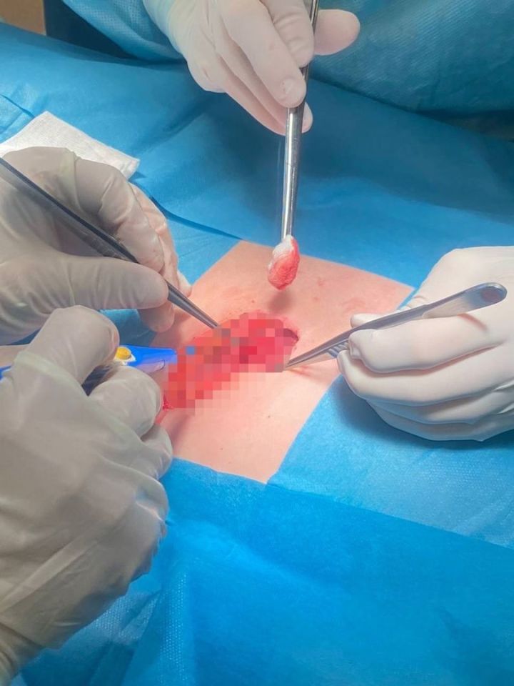 Врачи ДРКБ успешно провели сложную операцию по извлечению иглы из печени ребенка